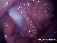 Le déclencheur à l'intérieur du vagin
